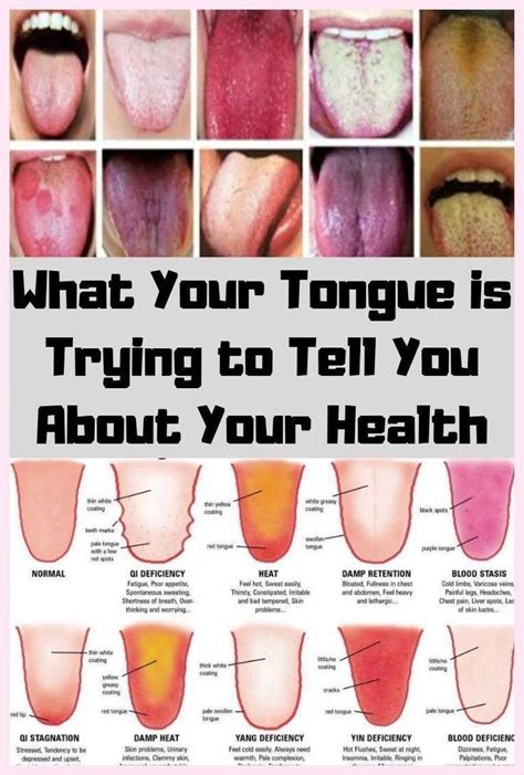 What Your Tongue Is Trying To Tell You About Your Health Healthy