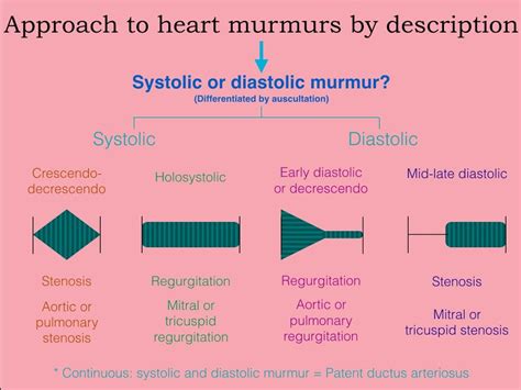 Murmur Heart Murmur Ductus Arteriosus Patent Ductus Arteriosus