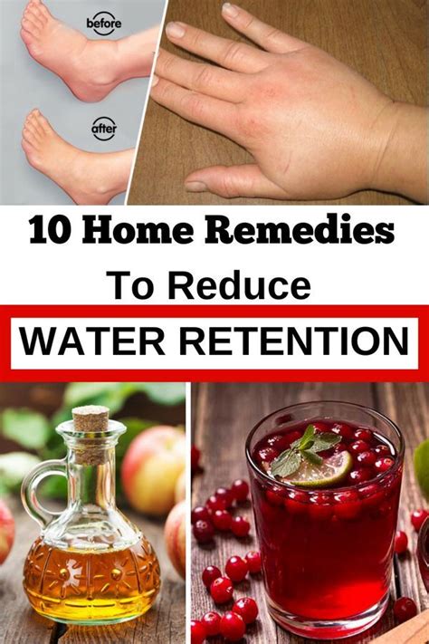 10 Home Remedies To Reduce Water Retention Water Retention Water