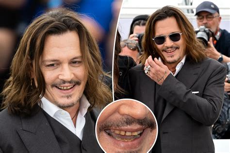 Johnny Depps Teeth Appear To Be Rotting Ladun Liadis News