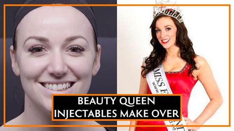 an all over injectables make over for a former beauty queen youtube