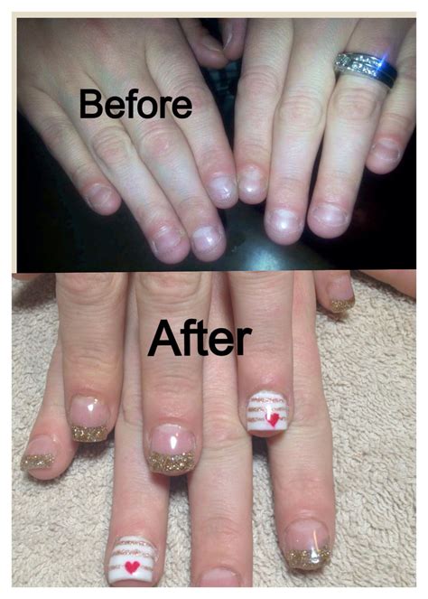 Life After Acrylic Nails Pmpdesignlab