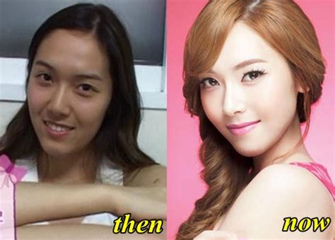 Jessica Jung Snsd Before Plastic Surgery