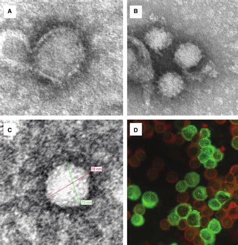 A B And C Electron Microscopy Images Of Vero E6 Cell Cultures