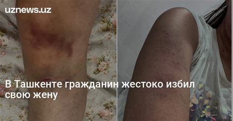 Uznews В Ташкенте гражданин жестоко избил свою жену