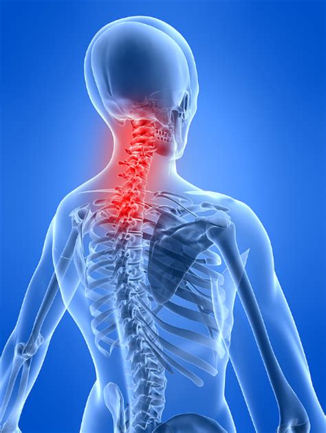 Preventing Cancer And Other Health Issues Neck And Back Pain