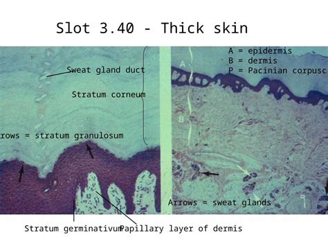 Ppt Slot 340 Thick Skin A Epidermis B Dermis P Pacinian