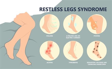 Restless Leg Syndrome Doctor In Manhattan Brooklyn And Nyc