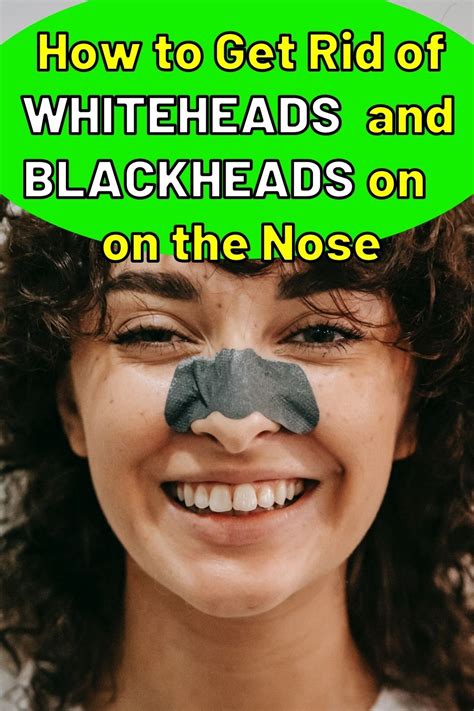 How To Get Rid Of Whiteheads And Blackheads On The Nose Epic Natural