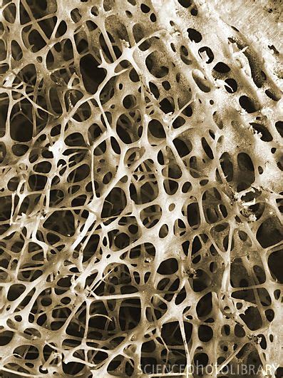 Inside Of A Bone Microscopic Photography Cancellous Bone Scanning
