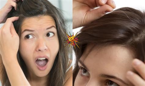 Are Your Hairs Turning Grey Dont Worry Do These Quick Solutions