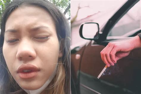 Cewek Ini Jadi Korban Pemotor Yang Merokok Di Jalan Mata Tak Bisa