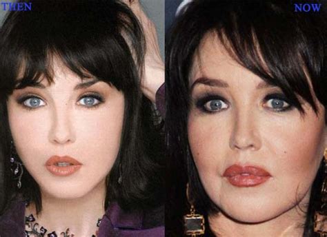 Isabelle Adjani Plastic Surgery Before And After Botox Nose Job And Lips Injections