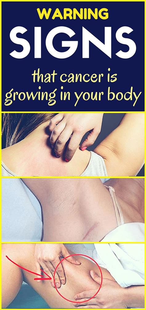 Early Warning Signs That Cancer Is Growing In Your Body Dont Ignore Them Healthy Lifestyle