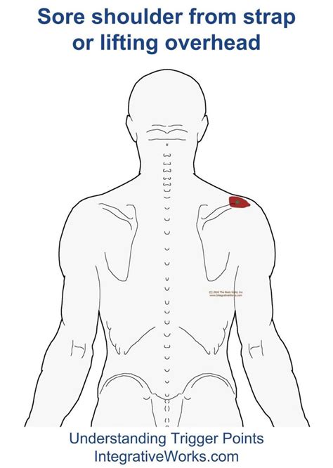 Pin On Shoulder Trigger Point Pain