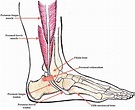 Peroneal tendonitis causes, symptoms, diagnosis, treatment & recovery