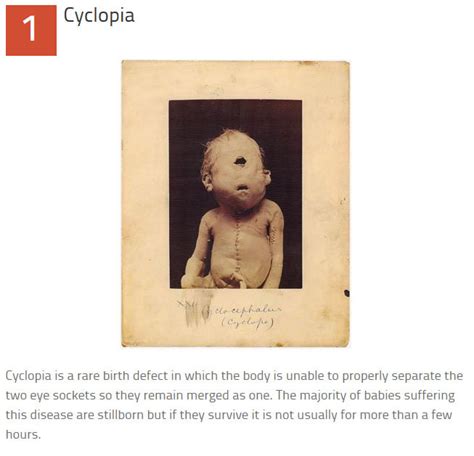 10 disturbing medical images throughout history others
