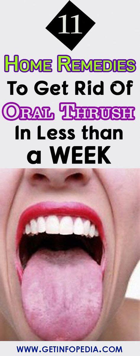 What Does Oral Thrush Look Like On The Tongue What Does