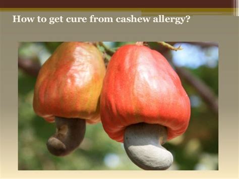 What Are The Symptoms Of Cashew Allergy