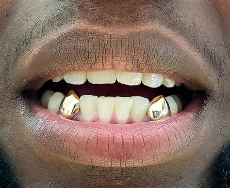 Our company made gold teeth for the movie industry as well as the music industry. Custom Grillz | Gold Grillz | Diamond Grillz | Custom Jewelry