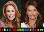 Roma Downey Plastic Surgery Before and After | Plastic Surgery Magazine