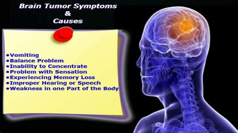 Brain Tumors Metrohealth Hmo