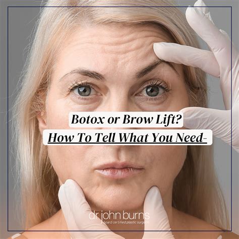 Botox Or Brow Lift How To Tell What You Really Need Nn Nn N