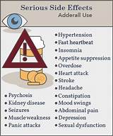 Adderal  R Side Effects