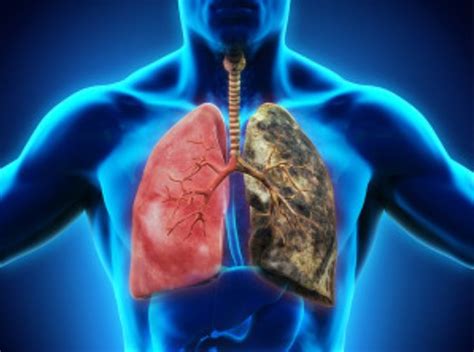 Copd And Lung Disease Facts University Health News