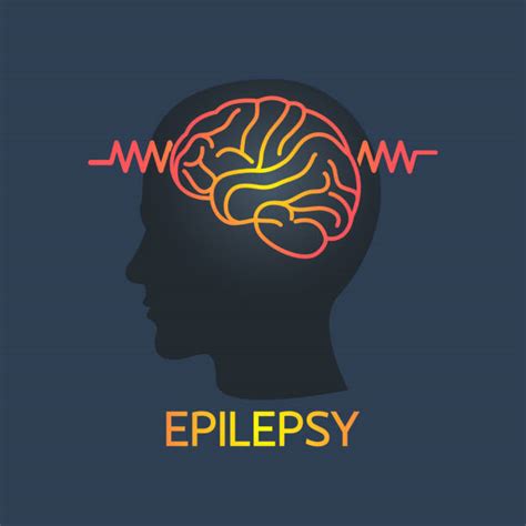 Epilepsy Illustrations Royalty Free Vector Graphics And Clip Art Istock