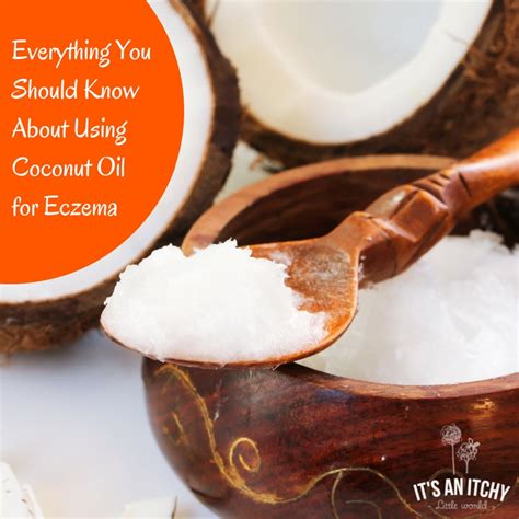 Everything You Should Know About Using Coconut Oil For Eczema Its An