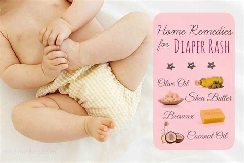21 Quick Natural Home Remedies For Diaper Rash In Babies