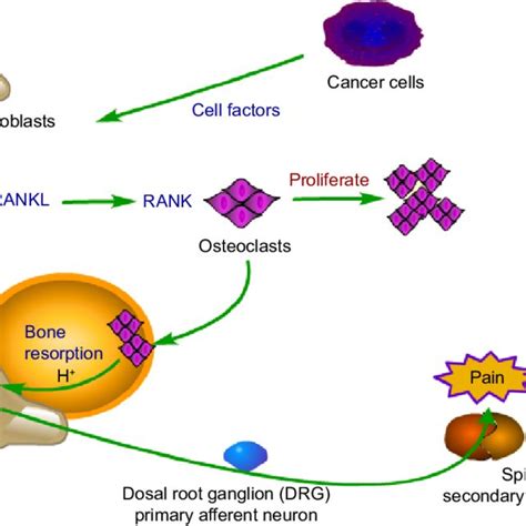 Mechanism Of Bone Cancer Pain Notes In The Process Of Bone Cancer