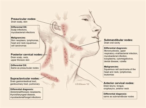 Lymphadenopathy Cancer Therapy Advisor