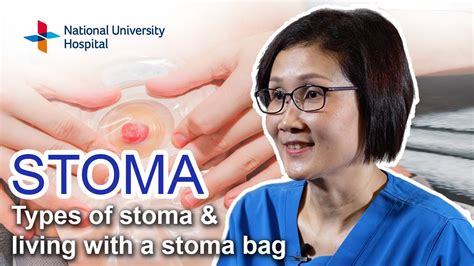 Stoma Types Of Stoma And Living With A Stoma Bag Youtube