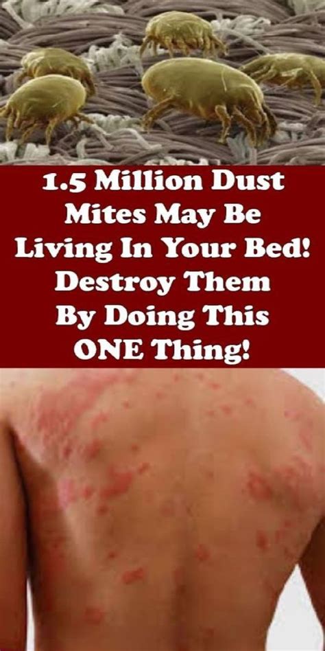 Destroy Bed Mites With This Trick Natural Remedies