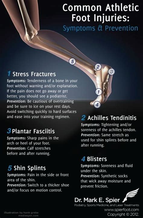 Pin By Ct Foot Care Centers On Foot Tips And Infographics Sports