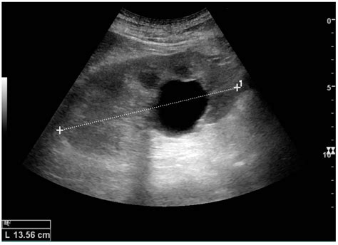 Diagnostics Free Full Text Ultrasonography Of The Kidney A