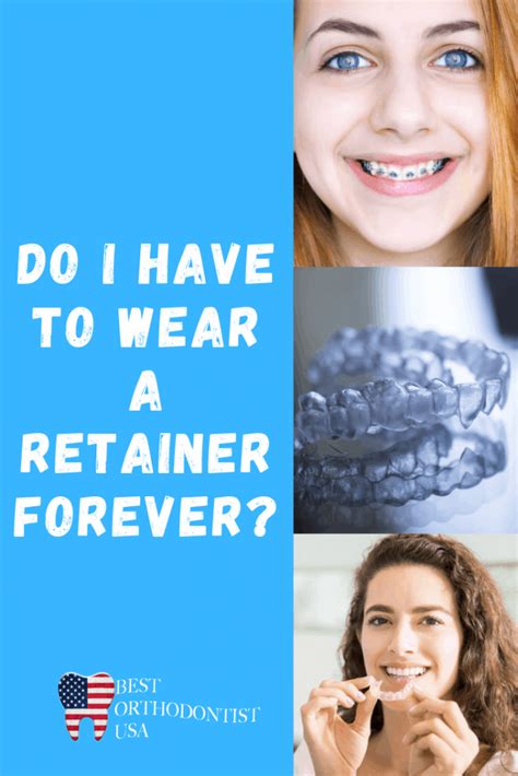 How Long Do You Have To Wear A Retainer For After Braces Why Do I
