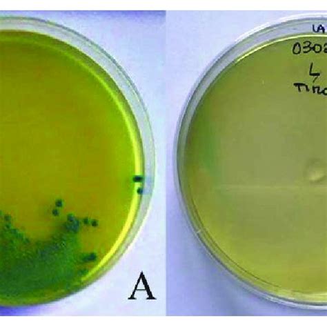 Growth Of L Innocua On Chromogenic Aloa Agar Listeria Acc To