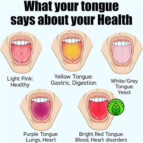 What Your Tongue Says About Your Health Healthy Tongue Health Tips Health