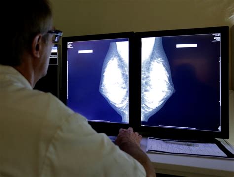 Men With Breast Cancers Are Opting For Double Mastectomies In Greater Number Science Times