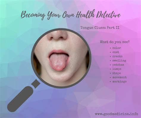 Health Clues In Your Tongue Part 2 Good Medicine