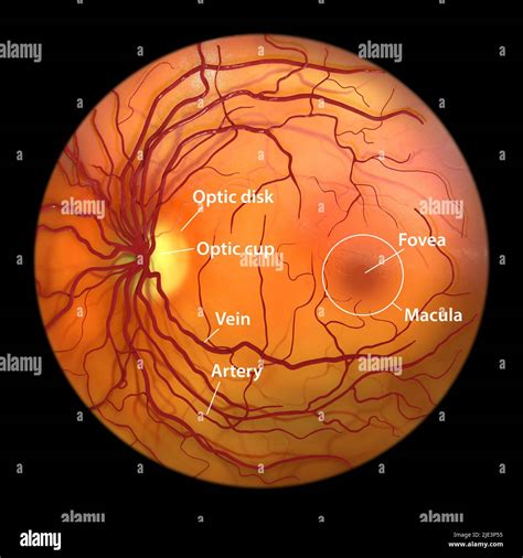 Normal Retina Ophthalmoscope Image Illustration The Retina Is The Light Sensitive Membrane