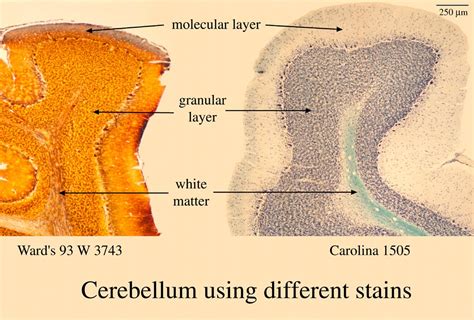 Cerebellar peduncles (named by position) 1. HISTOLOGY, Nervous System Lab, cerebellum slide