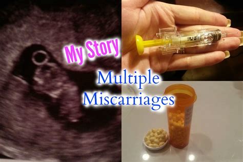 My Multiple Miscarriage Story Overcoming Recurrent Pregnancy Loss