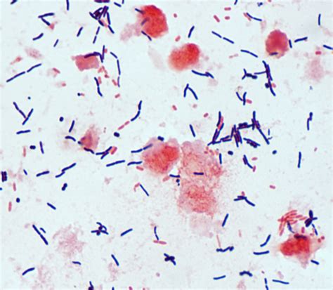 Toxigenic Clostridium Difficile Pcr University Of Washington