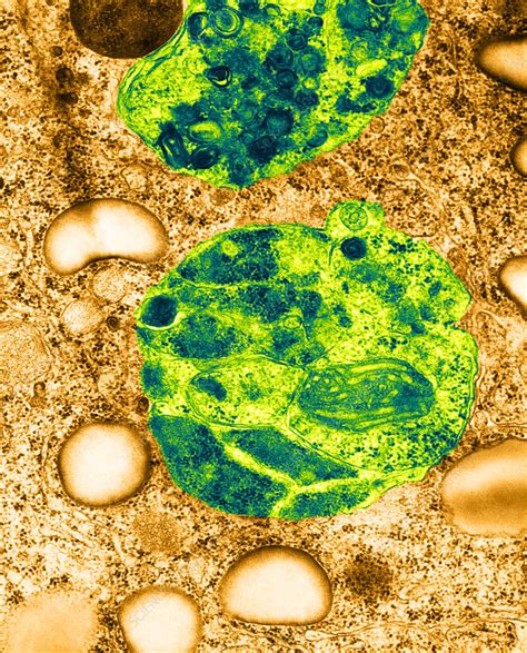 Lysosomes Tem Stock Image C0283719 Science Photo Library