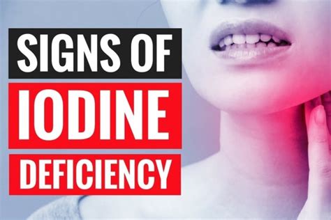 3 Signs And Symptoms Of Iodine Deficiency
