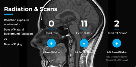 Mri Brain Scan Diagnostic Imaging Melbourne Radiology
